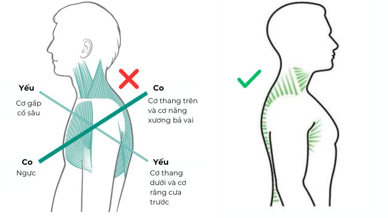 Một động tác thể dục dễ như chơi, nhưng chỉ cần 10 phút lập tức giảm đau vai cổ, cải thiện tư thế